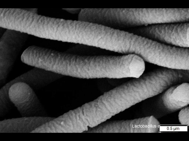 close up of Lactobacillus acidophilus: bacteria shaped like long gray tubes against a black background