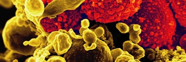 Methicillin-Resistant Staphylococcus aureus (MRSA) Bacteria