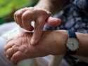 elderly woman rubbing her painful hand