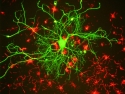 neuron in tissue culture