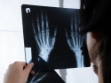 Female technician in white coat holds x rays of two hands up to the light
